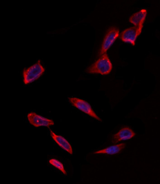 VDAC3 Antibody in Immunocytochemistry (ICC/IF)