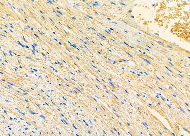 VDAC3 Antibody in Immunohistochemistry (Paraffin) (IHC (P))