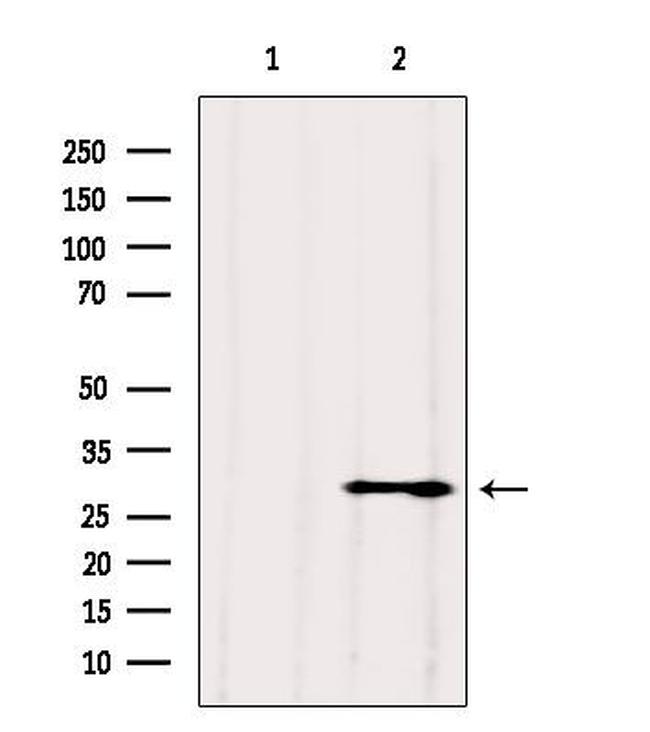 VDAC3 Antibody in Western Blot (WB)