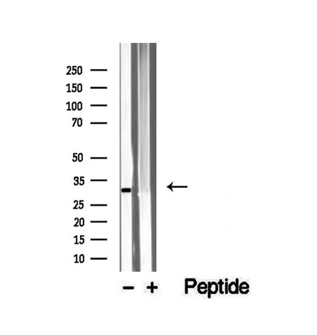 VDAC3 Antibody in Western Blot (WB)