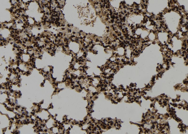 WDR18 Antibody in Immunohistochemistry (Paraffin) (IHC (P))