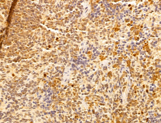 WDR18 Antibody in Immunohistochemistry (Paraffin) (IHC (P))