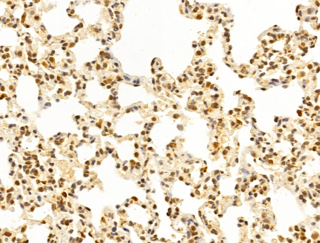 WDR18 Antibody in Immunohistochemistry (Paraffin) (IHC (P))