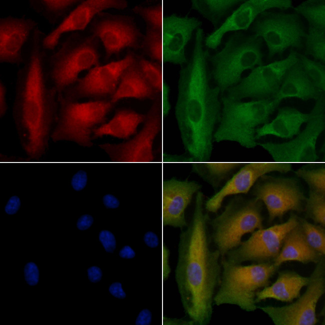 ABCB4 Antibody in Immunocytochemistry (ICC/IF)