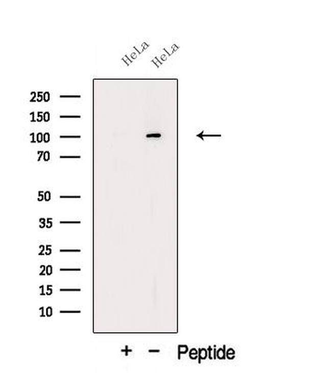 ORP6 Antibody in Western Blot (WB)