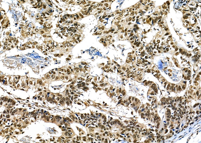 BCL9 Antibody in Immunohistochemistry (Paraffin) (IHC (P))