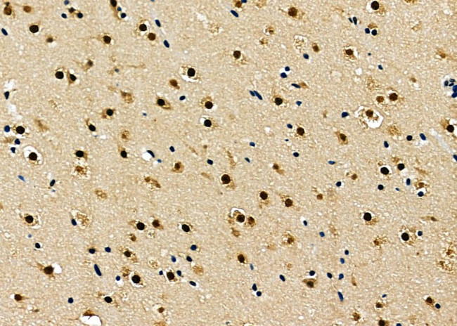 BCL9 Antibody in Immunohistochemistry (Paraffin) (IHC (P))