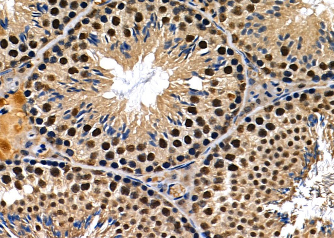 BCL9 Antibody in Immunohistochemistry (Paraffin) (IHC (P))