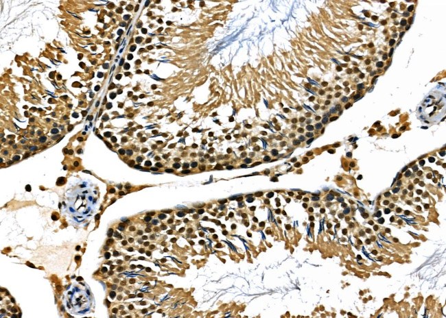 BCL9 Antibody in Immunohistochemistry (Paraffin) (IHC (P))