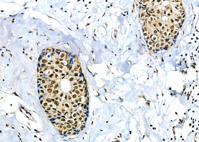 BCL9 Antibody in Immunohistochemistry (Paraffin) (IHC (P))