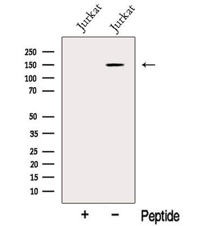 BCL9 Antibody in Western Blot (WB)