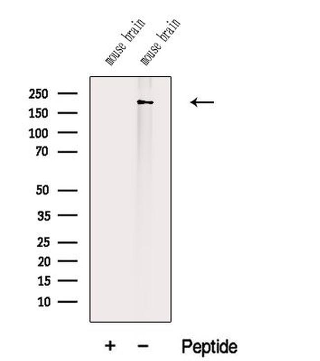 Titin Antibody in Western Blot (WB)