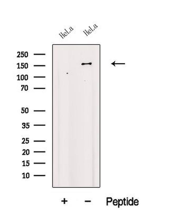 FBXL10 Antibody in Western Blot (WB)