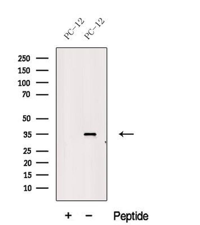 MSI2 Antibody in Western Blot (WB)