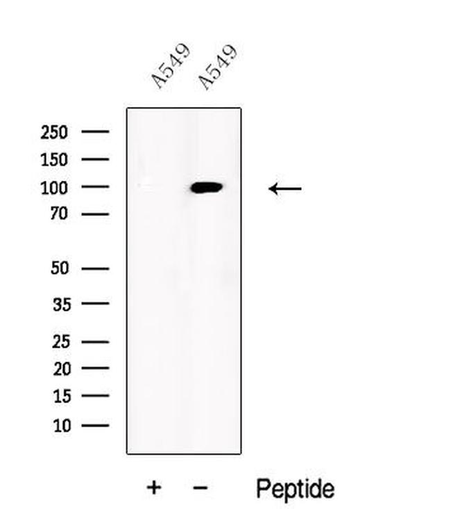 USP5 Antibody in Western Blot (WB)