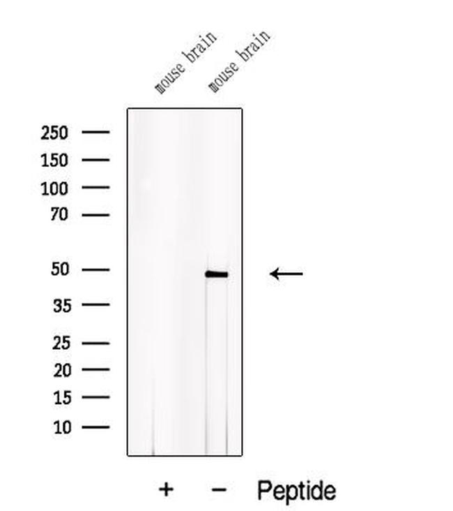 ACTR10 Antibody in Western Blot (WB)