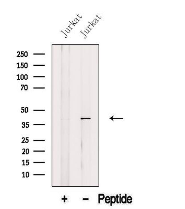 AUP1 Antibody in Western Blot (WB)