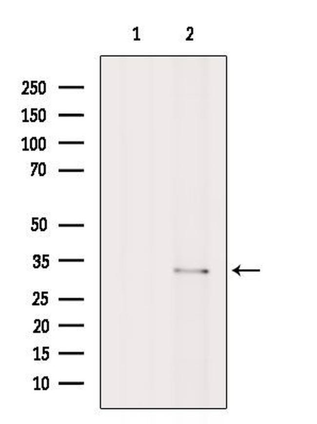 CHMP2B Antibody in Western Blot (WB)