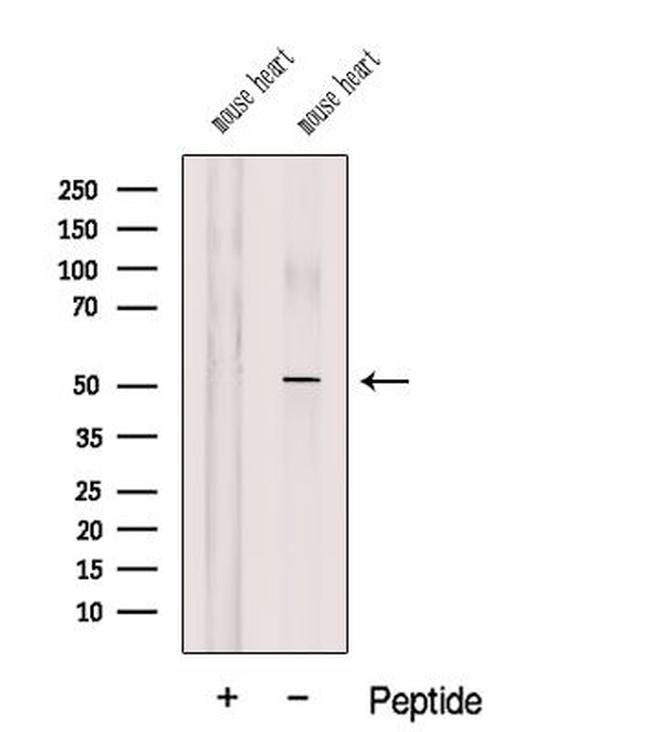 COQ6 Antibody in Western Blot (WB)