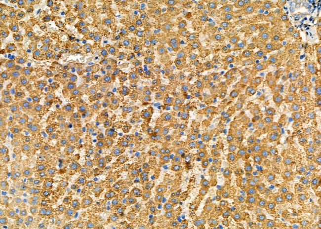 NG2 Antibody in Immunohistochemistry (Paraffin) (IHC (P))