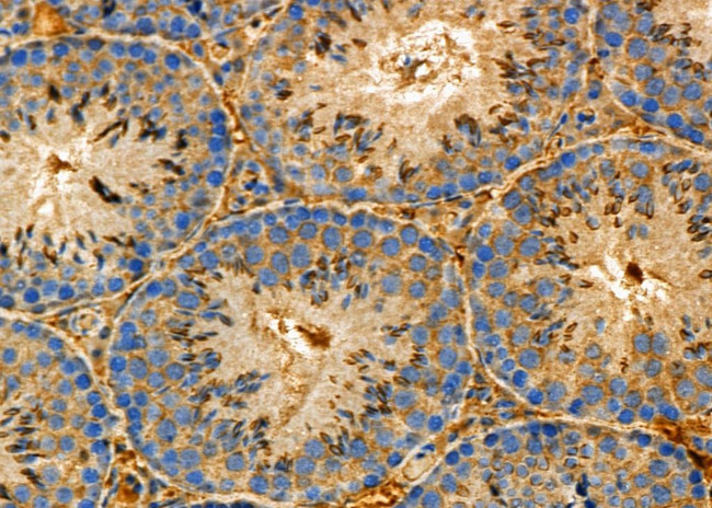 NG2 Antibody in Immunohistochemistry (Paraffin) (IHC (P))