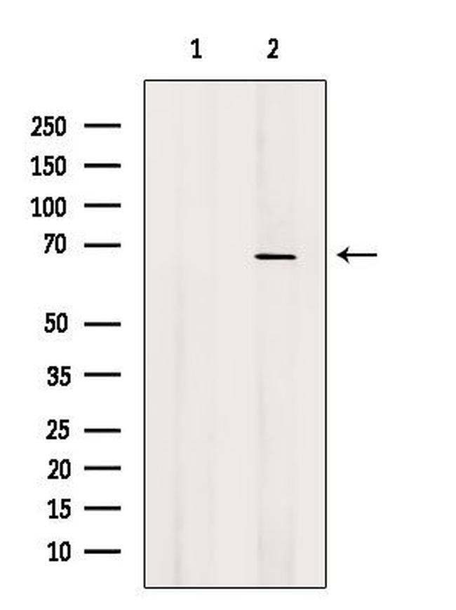 CTPS2 Antibody in Western Blot (WB)