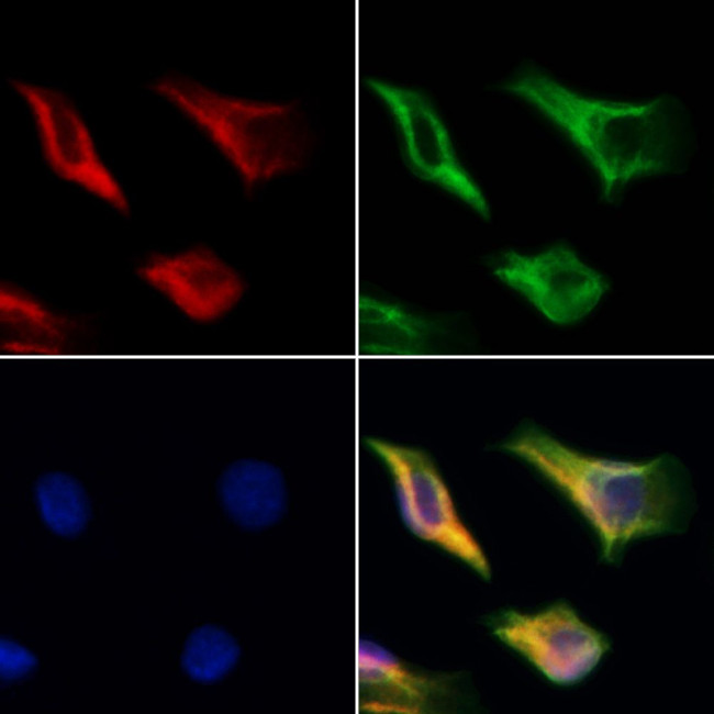 DARS2 Antibody in Immunocytochemistry (ICC/IF)