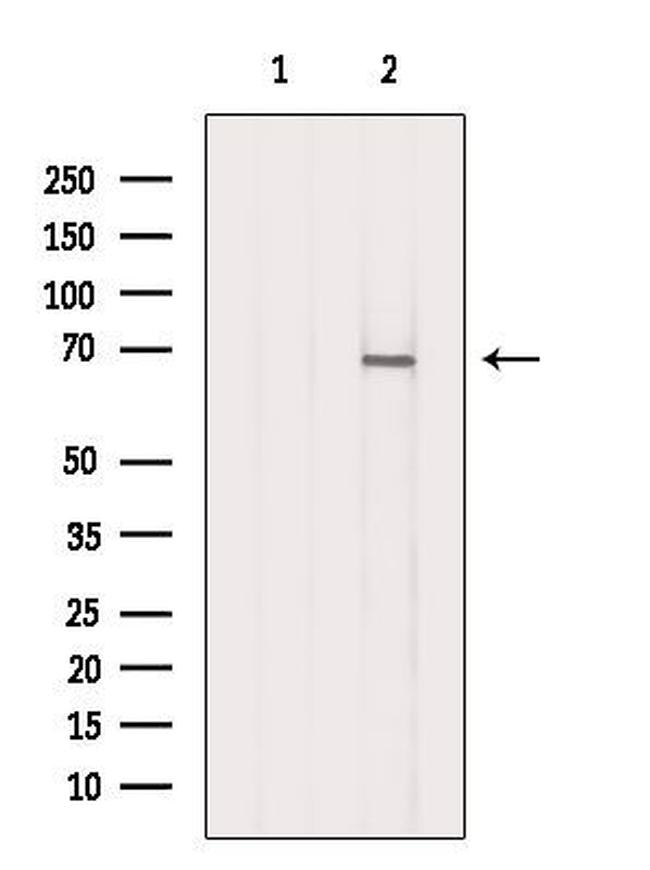 DARS2 Antibody in Western Blot (WB)