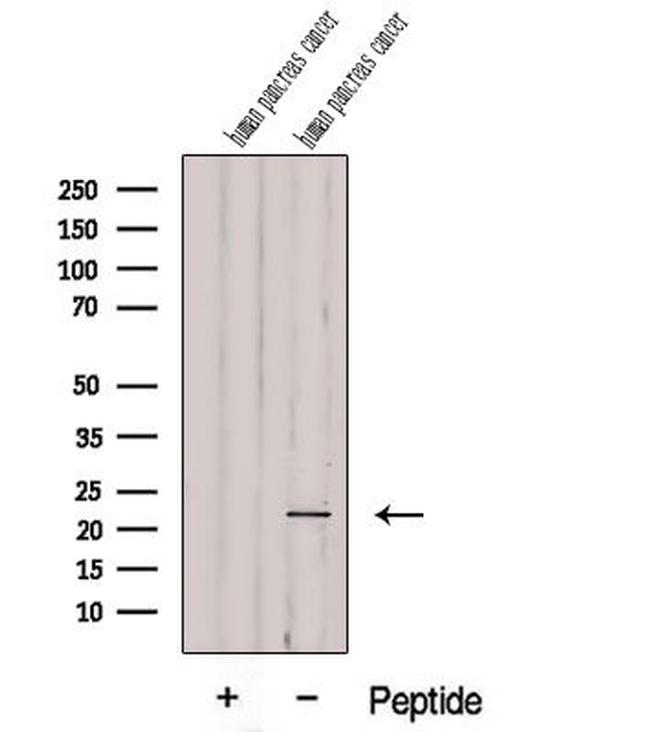 DDIT4L Antibody in Western Blot (WB)