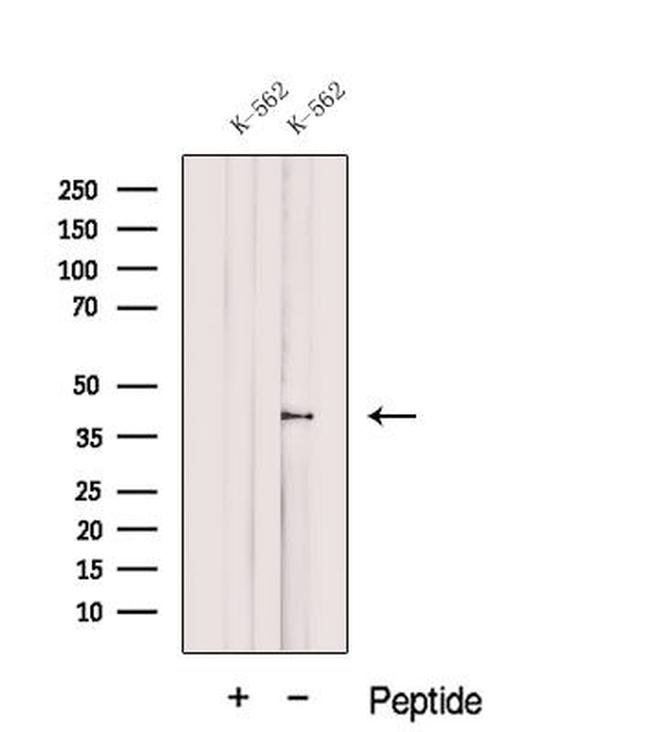 DUSP11 Antibody in Western Blot (WB)