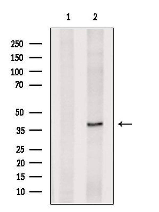 DUSP11 Antibody in Western Blot (WB)