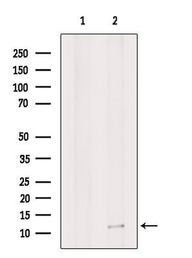 G0S2 Antibody in Western Blot (WB)