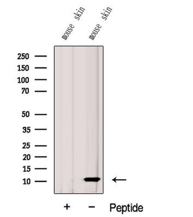 G0S2 Antibody in Western Blot (WB)