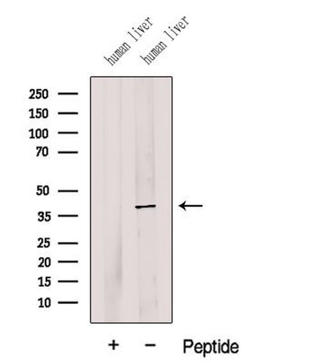 G6PC Antibody in Western Blot (WB)