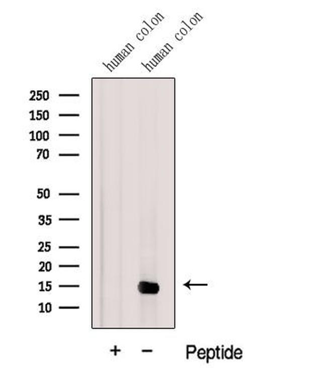 Galectin 2 Antibody in Western Blot (WB)