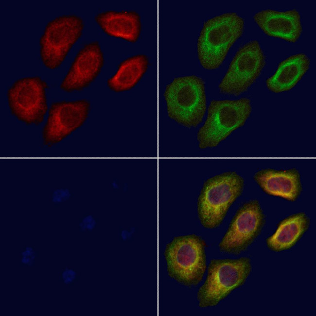 GGCX Antibody in Immunocytochemistry (ICC/IF)