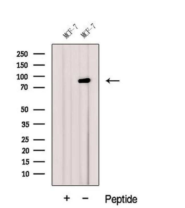 GGCX Antibody in Western Blot (WB)