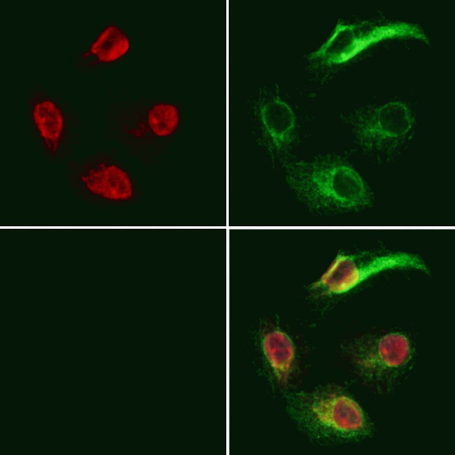 GNAQ Antibody in Immunocytochemistry (ICC/IF)