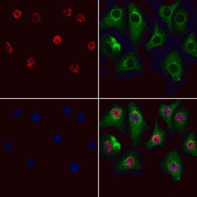 GSTO2 Antibody in Immunocytochemistry (ICC/IF)