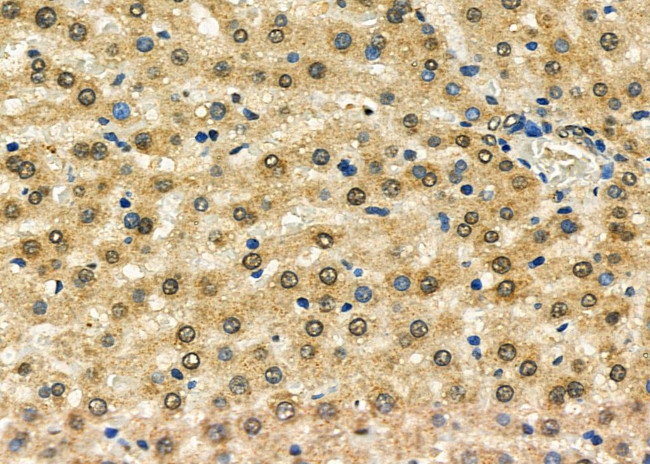 GSTO2 Antibody in Immunohistochemistry (Paraffin) (IHC (P))