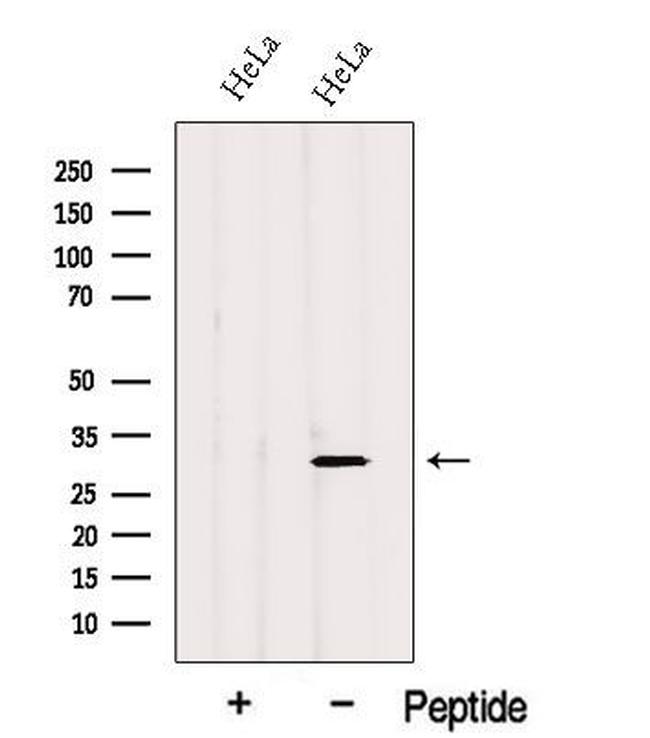 GSTO2 Antibody in Western Blot (WB)