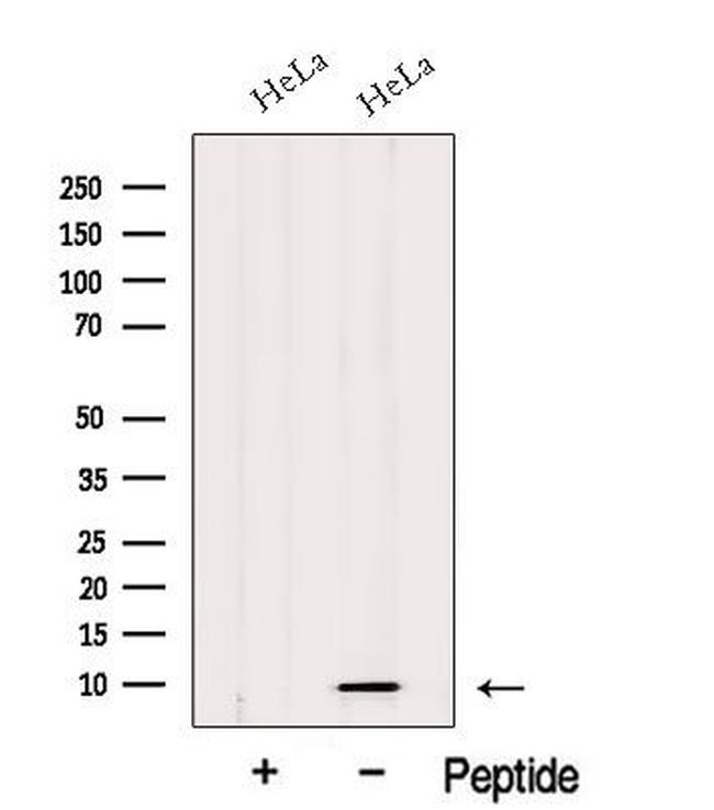 HIGD1A Antibody in Western Blot (WB)