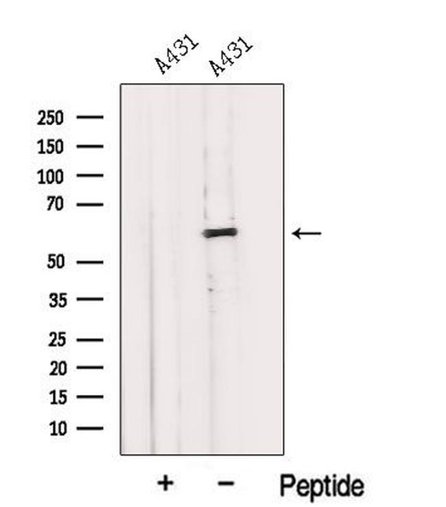 IMPDH1 Antibody in Western Blot (WB)