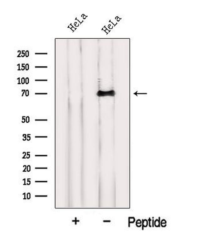 INTS10 Antibody in Western Blot (WB)