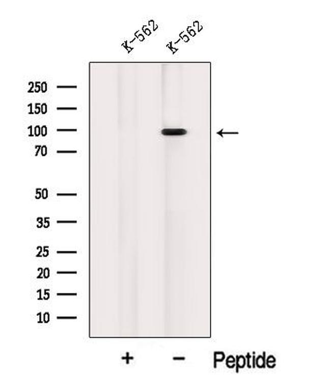 INVS Antibody in Western Blot (WB)