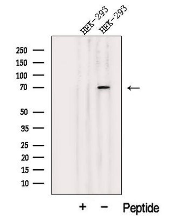 JAKMIP1 Antibody in Western Blot (WB)