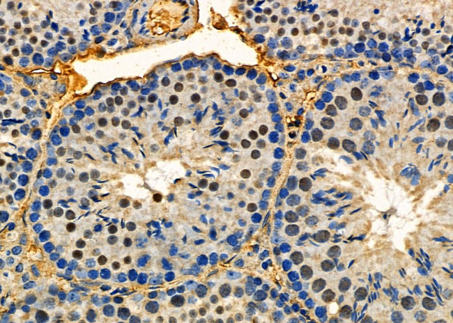 MED12 Antibody in Immunohistochemistry (Paraffin) (IHC (P))