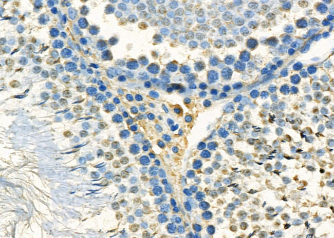 MED12 Antibody in Immunohistochemistry (Paraffin) (IHC (P))