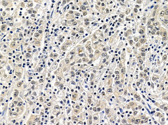 NHP2 Antibody in Immunohistochemistry (Paraffin) (IHC (P))