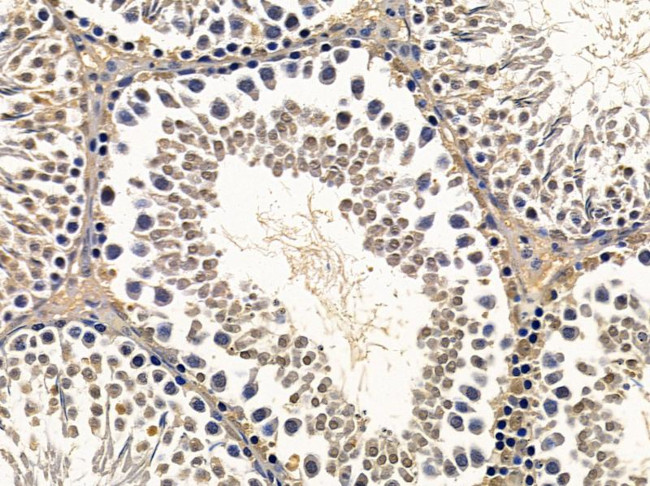 NHP2 Antibody in Immunohistochemistry (Paraffin) (IHC (P))